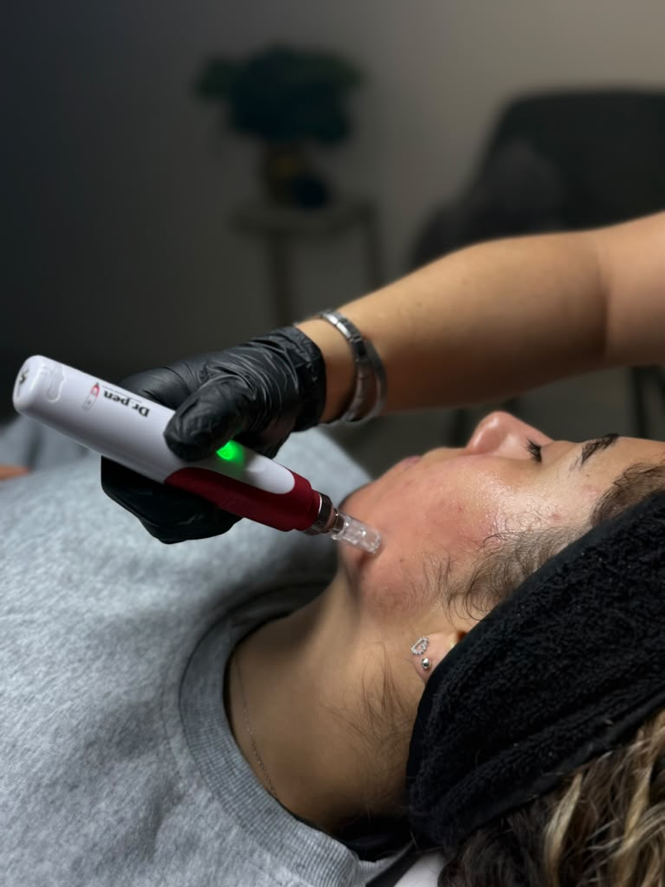 Dermapen